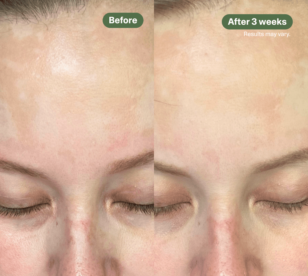 BA Dark Spot